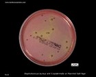 staphylococcus on mannitol salt agar